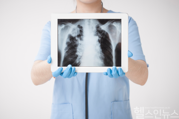 오목가슴은 외형을 넘어 심폐 기능과 자존감에 영향을 미치며, 조기 진단과 맞춤 치료가 중요하다. (클립아트코리아)