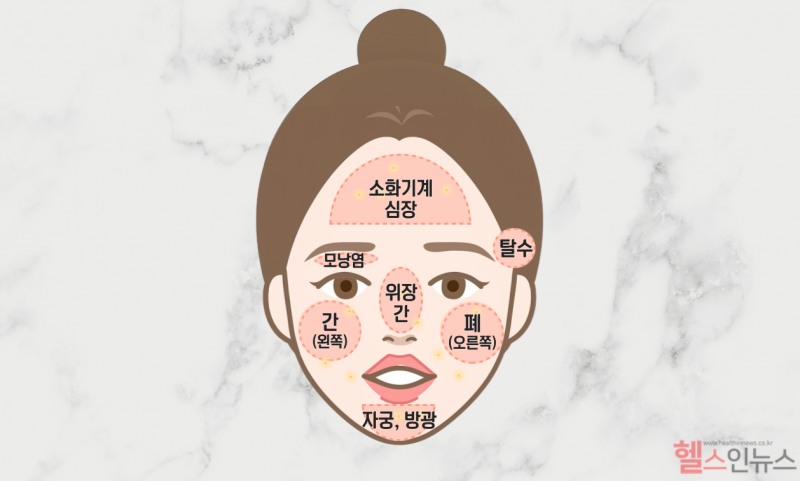 얼굴에 난 뾰루지의 위치로 건강 상태를 점검해볼 수 있다. 특히 염증처럼 아프게 난 뾰루지는 해당 부위의 건강 상태와 연관이 깊을 수 있다. (이미지 디자인 =GDH AI Design Team)