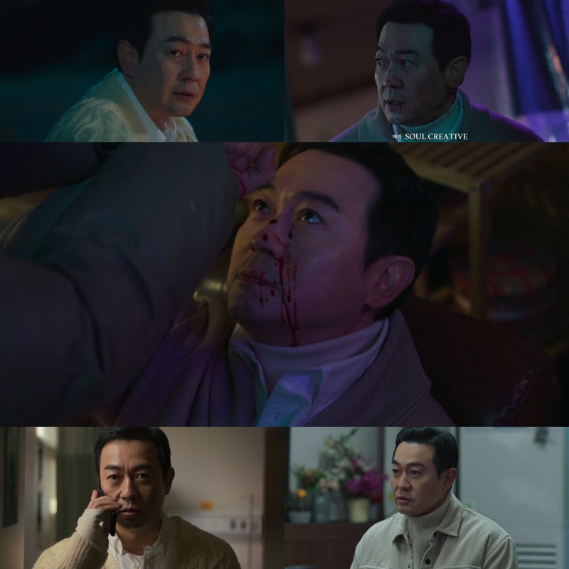 ‘메스를 든 사냥꾼’ 박용우, 광기 어린 모습 갓벽 소화…섬찟한 분위기 폭발