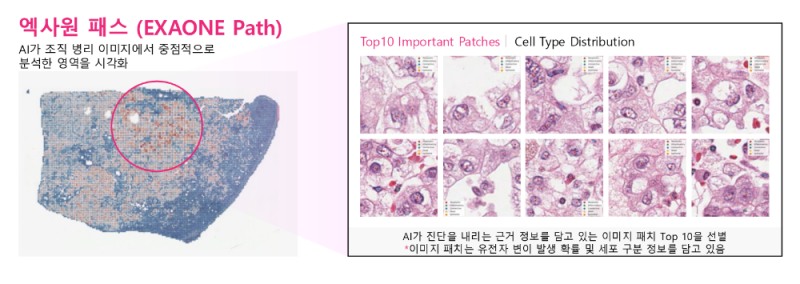 엑사원 패스는 전체 슬라이드 이미지(WSI)에서 암과 관련된 유전자 변이를 예측할 수 있다