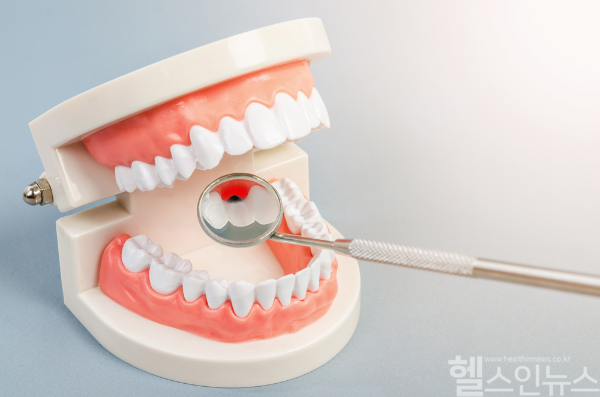 치은염·치아 상실 등 구강질환이 암 발생과 사망 위험을 높이는 독립 요인이 될 수 있다. (클립아트코리아)