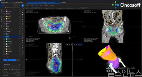 Qt그룹, 온코소프트와 의료 AI 협력 강화 (Qt그룹 제공)