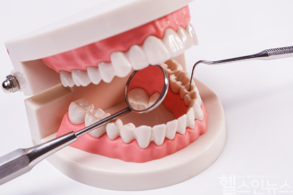잇몸병은 뇌졸중과 치매 위험을 높이는 전신 건강의 경고 신호다. (클립아트코리아)