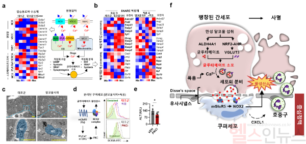 폭음에 의해 유도되는 글루타메이트 신호 경로를 통한 간세포-쿠퍼세포 간 상호작용과 알코올성 간질환 발병 기전 (여의도성모병원 제공)