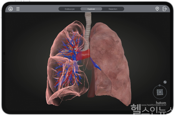 휴톰 RUS LUNG 3D 입체 화면 이미지 (휴톰 제공)