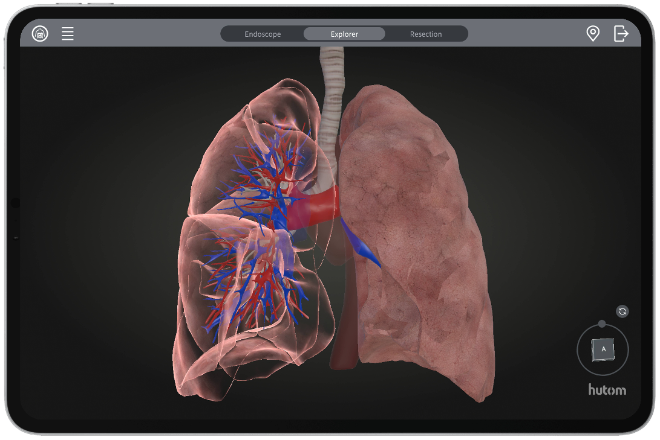 휴톰 RUS LUNG 3D 입체 화면 이미지 ⓒ휴톰