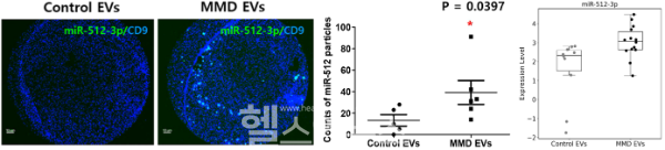 모야모야병 환자(MMD)와 정상 대조군(Control)의 혈장에서 분리한 세포외소포 내 miRNA를 분석한 결과. 환자군에서 miR-512-3p의 발현(Expression Level)이 유의미하게 높은 것으로 나타났다. (서울대병원 제공)
