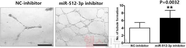 miR-512-3p 억제제 처리 후 모야모야병 환자 세포에서 혈관 형성 능력이 유의미하게 향상됨. NC-inhibitor 처리군과 비교하여 miR-512-3p 억제제 처리군에서 혈관 형성 능력이 향상된 결과가 나타남 (서울대병원 제공)