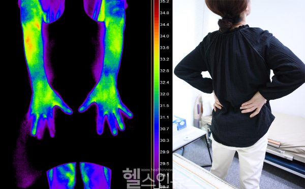 미래본병원 수족냉증 적외선 촬영 및 허리통증 이미지 (미래본병원 제공)
