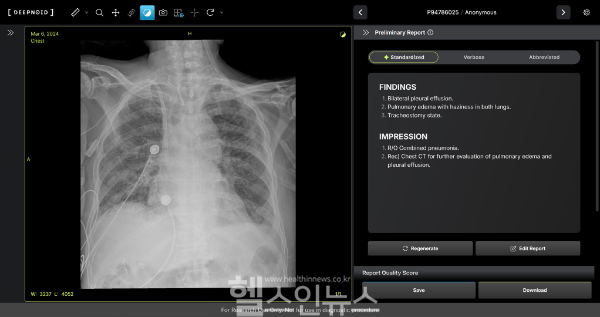 M4CXR 판독 예시 (딥노이드 제공)
