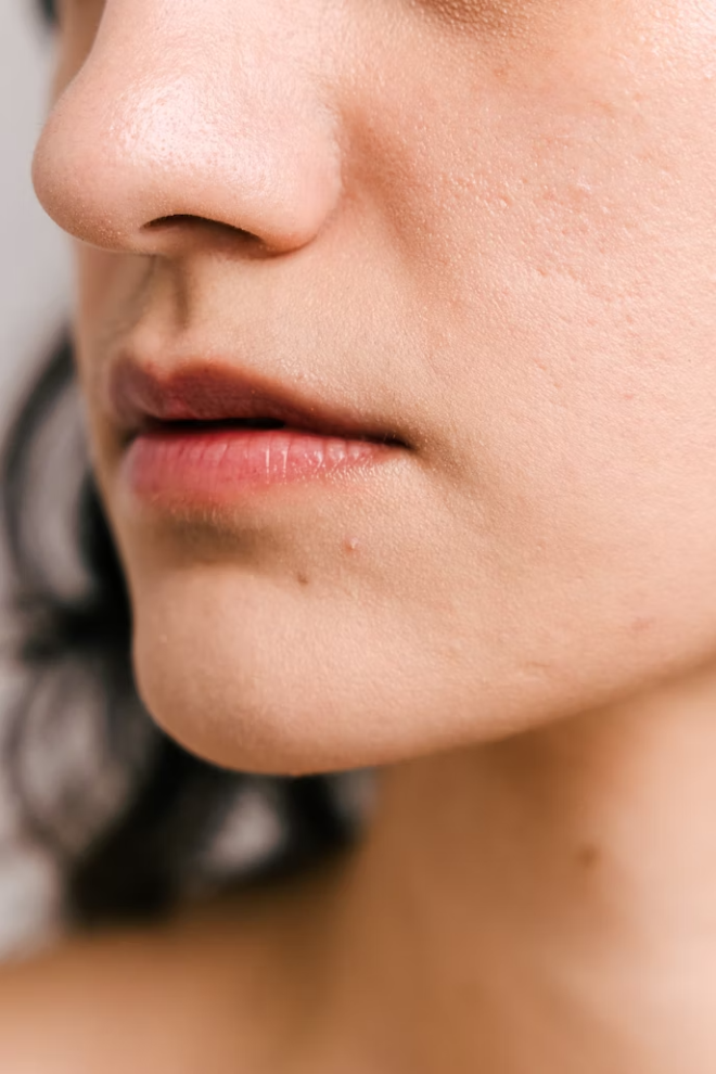 내 피부를 망치는 주범 '속건조'… 해결 방법은?