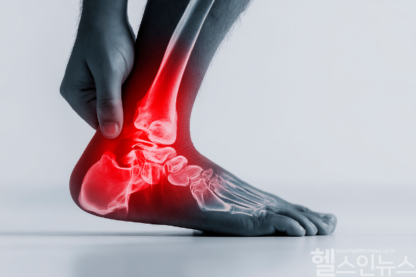 족관절 염좌는 초기 치료와 꾸준한 예방 관리가 필수인 여름철 대표 스포츠 부상이다. (클립아트코리아)