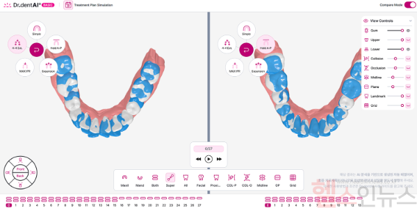 이노디테크 닥터덴트AI 시뮬레이션 서비스 (이미지 제공=이노디테크)