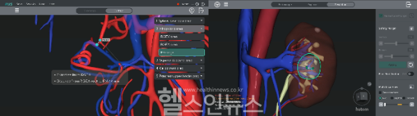 (왼쪽부터) RUS GA (Stomach) 제품 이미지, RUS NE (Kidney) 제품 이미지 (이미지 제공=휴톰)