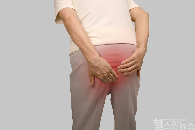 오랜 시간 앉아 있거나 변비가 지속되면 항문 정맥의 압력이 높아져 치질이 생길 수 있다 / 사진=클립아트코리아