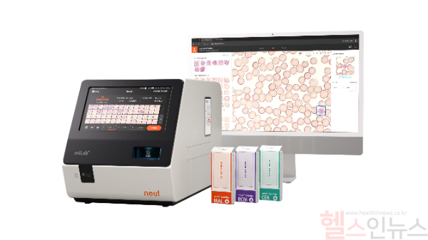 노을 AI 기반 혈액 및 암 진단 플랫폼 마이랩(miLab) 디바이스와 카트리지 (사진 제공=노을)