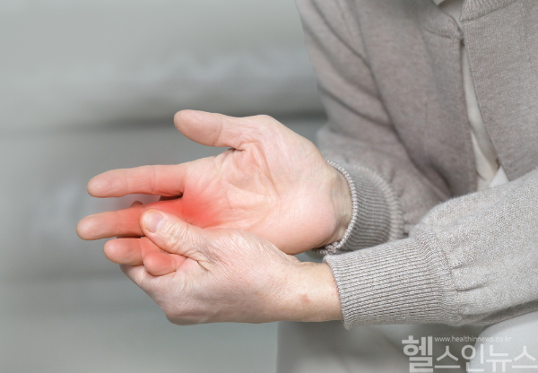 손발 부종은 단순 피로가 아니라 심장, 신장 등 주요 장기 이상 신호일 수 있어 정확한 진단과 생활습관 개선이 필요하다.