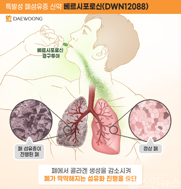 대웅제약 베르시포로신(DWN12088) 작용 기전 (사진 제공=대웅제약)