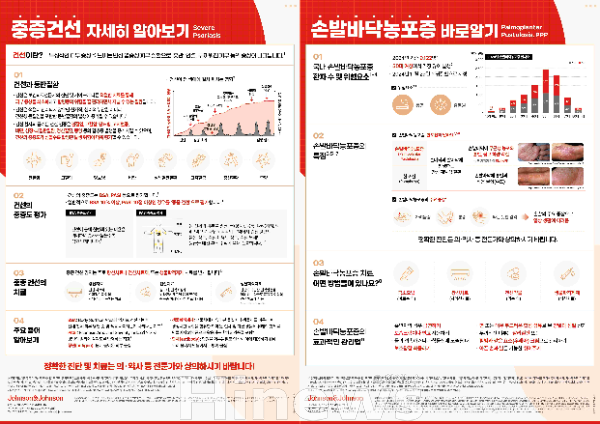 중증 건선·손발바닥 농포증 인포그래픽 (사진 제공=존슨앤드존슨)