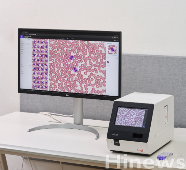 전혈구검사(CBC)를 통합한 완전 자동화 혈액 분석 솔루션 ‘miLab BCM’ (사진 제공=노을)
