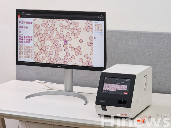 노을 AI 기반 말라리아 솔루션(miLab MAL) (사진 제공=노을)