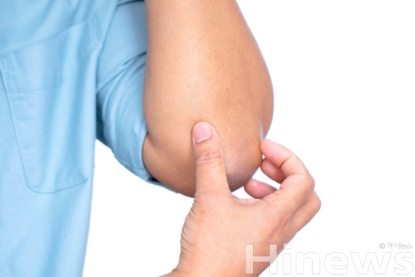 겨울철 건선은 추위와 건조로 악화되므로 보습과 생활 습관 관리가 필수다. (사진 제공=클립아트코리아)