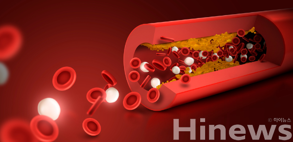 운동만으로 고지혈증 관리 어렵고, 유산소 운동·체중·식습관 조절과 정기 검진이 필수다. (사진 제공=클립아트코리아)