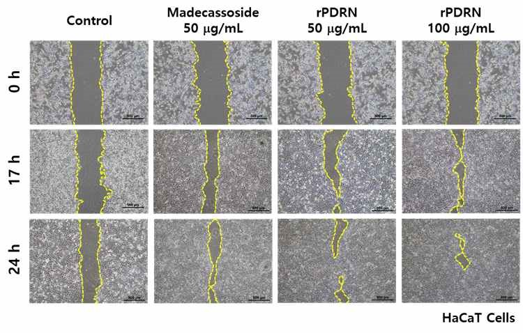 재조합 PDRN의 인간 각질세포에서의 wound healing 효능 평가