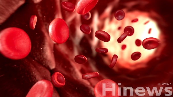 혈액암, 특히 림프종은 초기 증상이 미묘해 조기 발견이 어렵고, 정확한 진단과 치료가 생존율 향상에 결정적이다. (사진 제공=클립아트코리아)