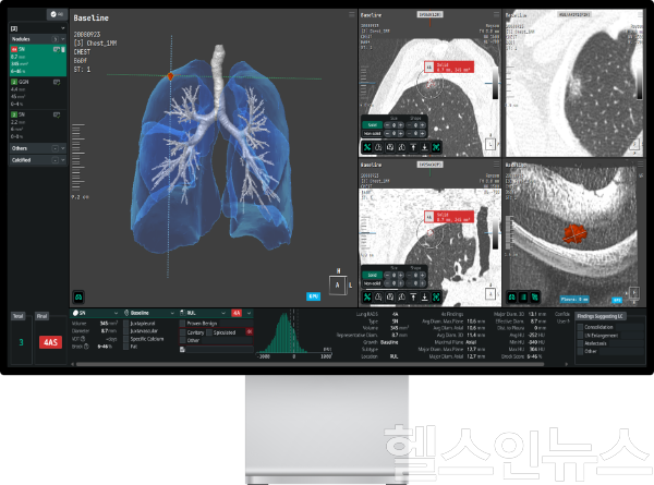 Coreline Softs AVIEW (사진 제공=코어라인소프트)