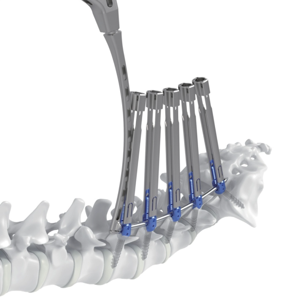 메드트로닉코리아가 ‘강휘’를 출시하며 메드트로닉 척추 솔루션에 대한 접근성을 확대한다. (사진 제공=메드트로닉코리아)