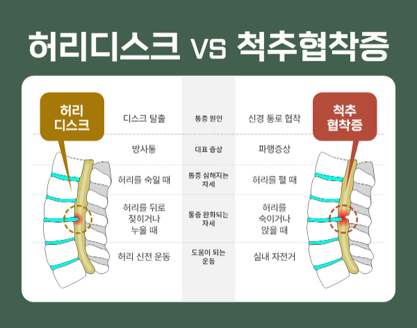 허리디스크 vs 척추협착증 (사진 제공=힘찬병원)