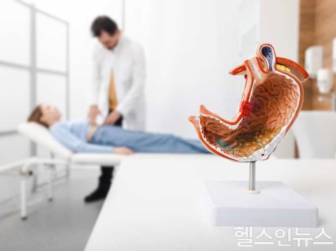 위 점막 재생을 방해하는 술과 담배를 멀리하고, 규칙적인 식사와 스트레스 관리를 병행하면 위궤양의 재발을 효과적으로 막을 수 있다. (이미지 제공=클립아트코리아)