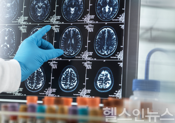 뇌졸중 회복의 성패는 급성기 이후 아급성기 동안 집중적 치료와 신경 재활에 달려 있다. (사진 제공=클립아트코리아)