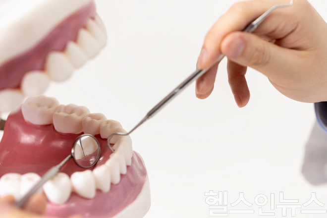 잇몸 질환의 주범인 치석은 양치질만으로는 제거되지 않으므로 정기적인 스케일링을 통해 잇몸 속 염증 발생을 차단해야 한다. (이미지 제공=클립아트코리아)