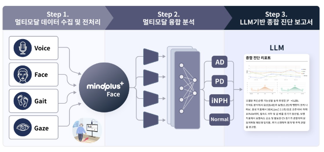 <그림> MindPlus-Face — 4모달리티 융합 퇴행성뇌질환 진단보조 SaMD 개념도