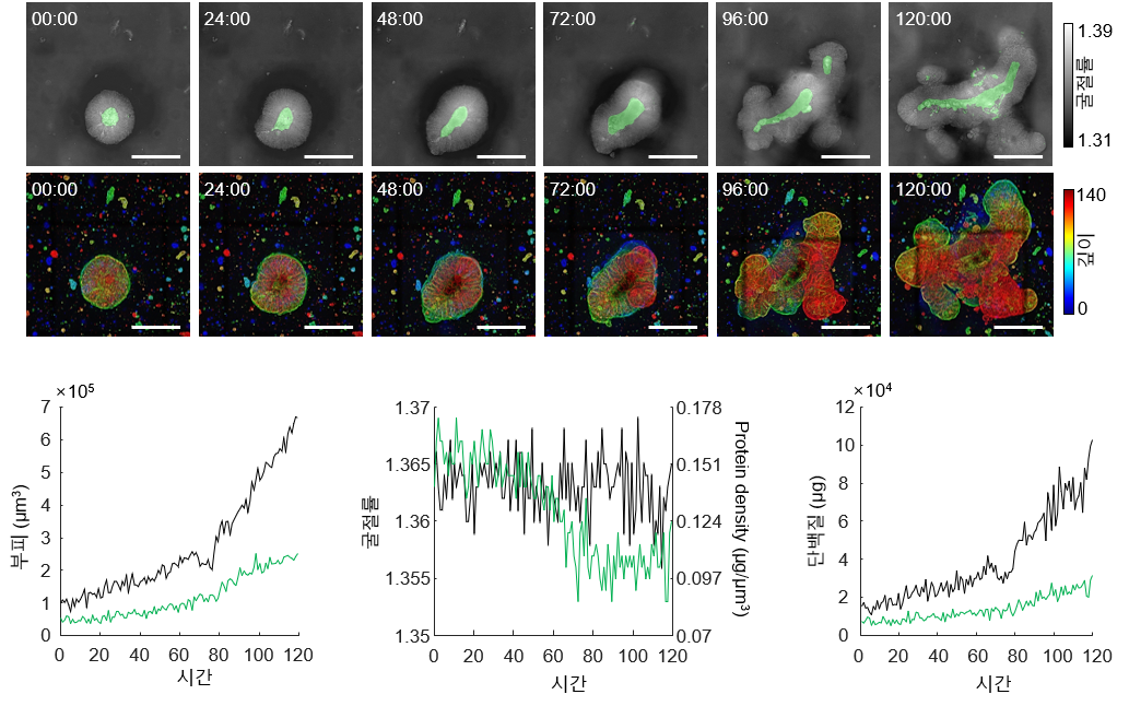 실시간 오가노이드 형태 분석