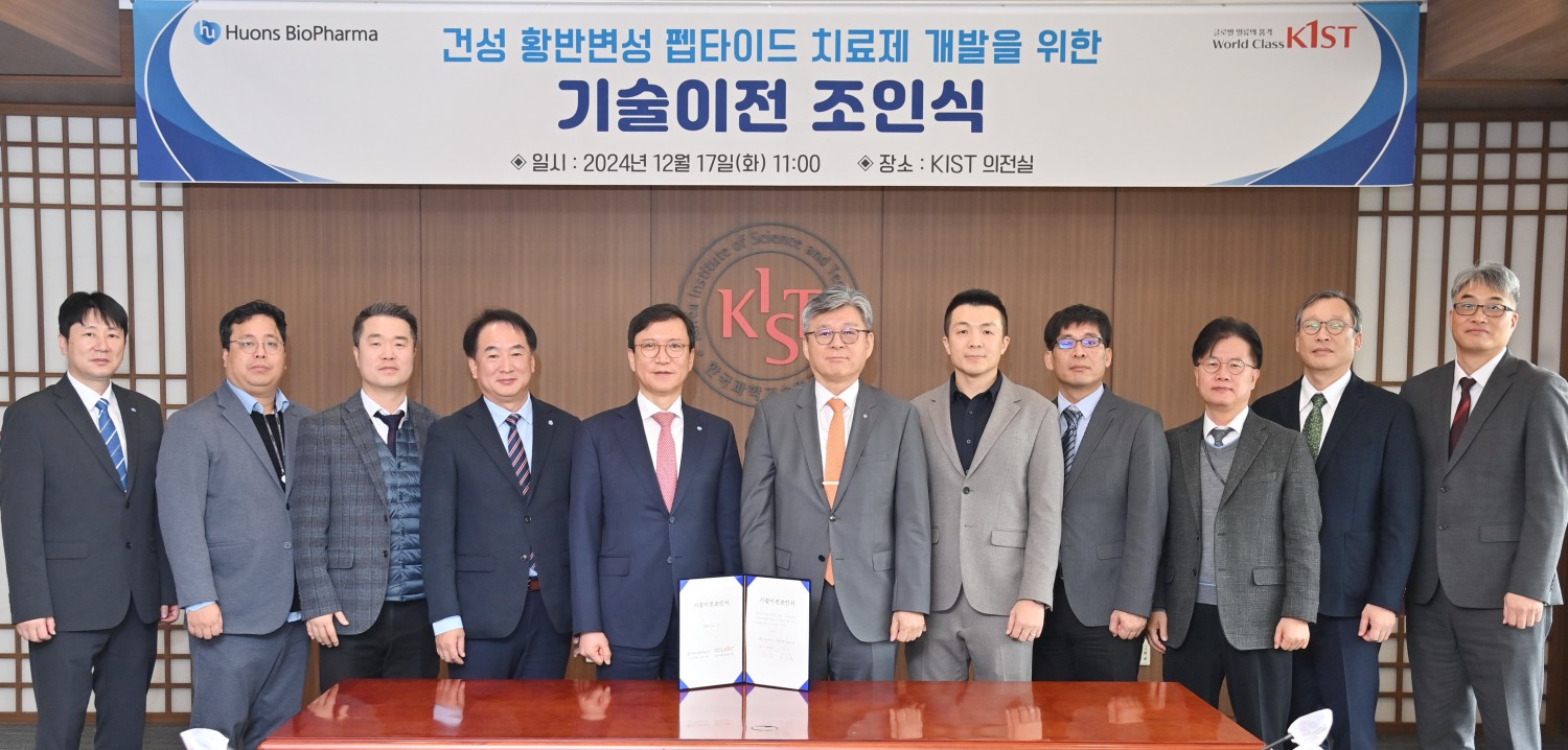 휴온스바이오파마, KIST와 ‘건성 황반변성 점안제 개발’ 협약 체결