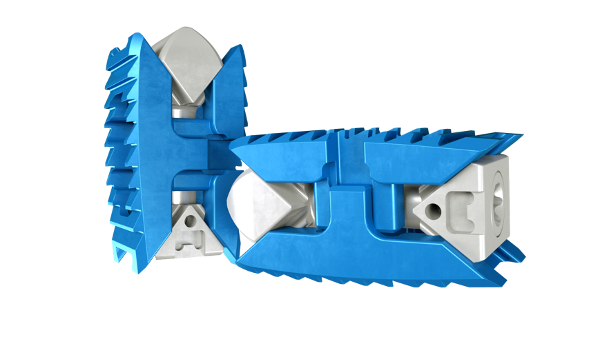 엘앤케이바이오메드, 유럽, 동남아시아 등에서 ‘엑셀픽스-XT’ 활용한 수술 연이어 성공