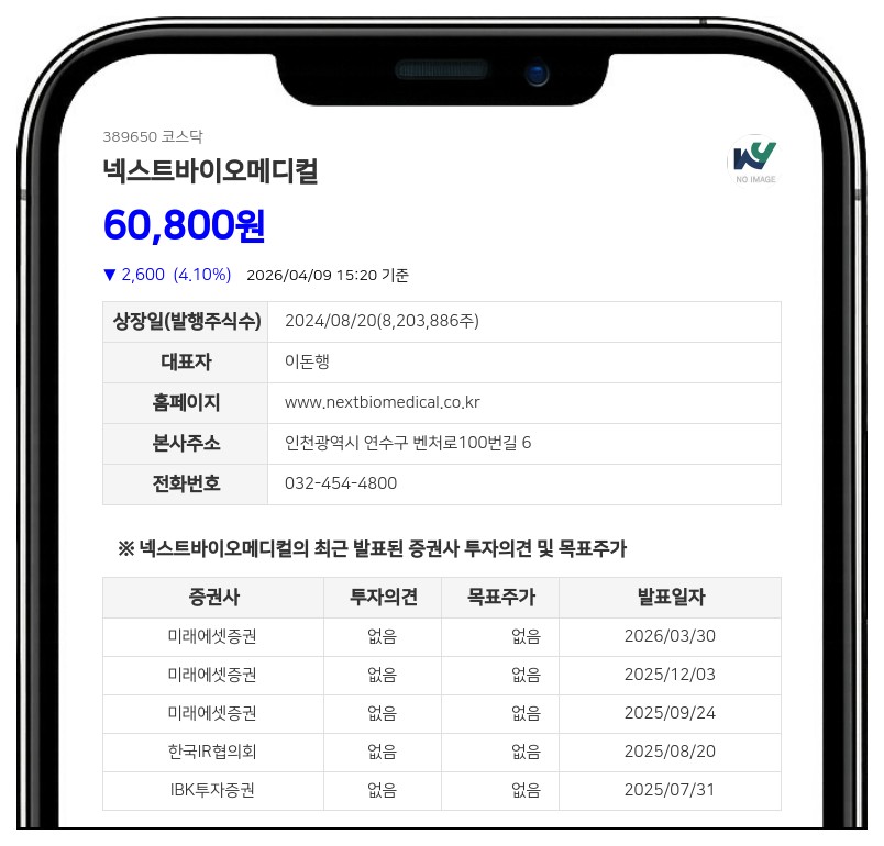 넥스트바이오메디컬, 일본 아사히 인텍과 'Nexsphere-F' 5+5년 독점 판권 계약