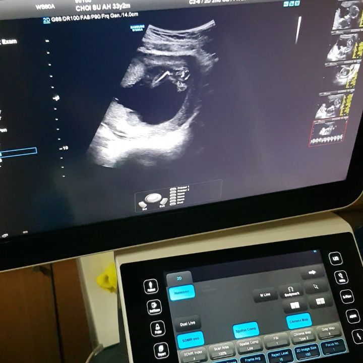 사진출처=정재형SNS캡처