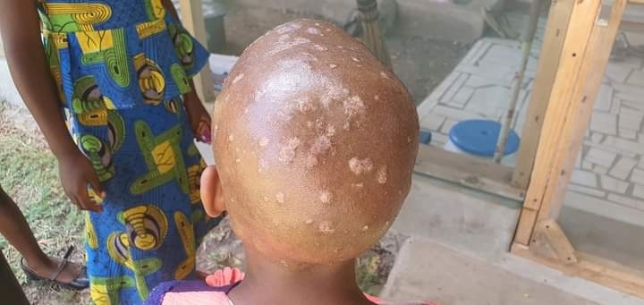 (사)아미유AMU 탄자니아 의료 사각지대에 보건소 건립 추진, “건강한 삶을 위하여”