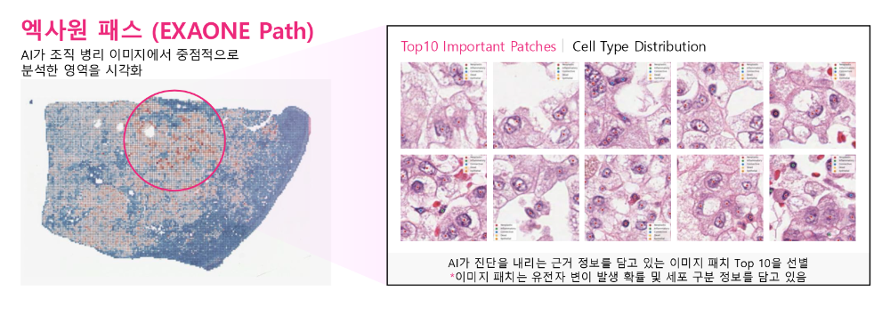 엑사원 패스는 전체 슬라이드 이미지(WSI)에서 암과 관련된 유전자 변이를 예측할 수 있다